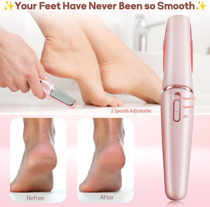 Callus Remover for Feet,  Electric Foot