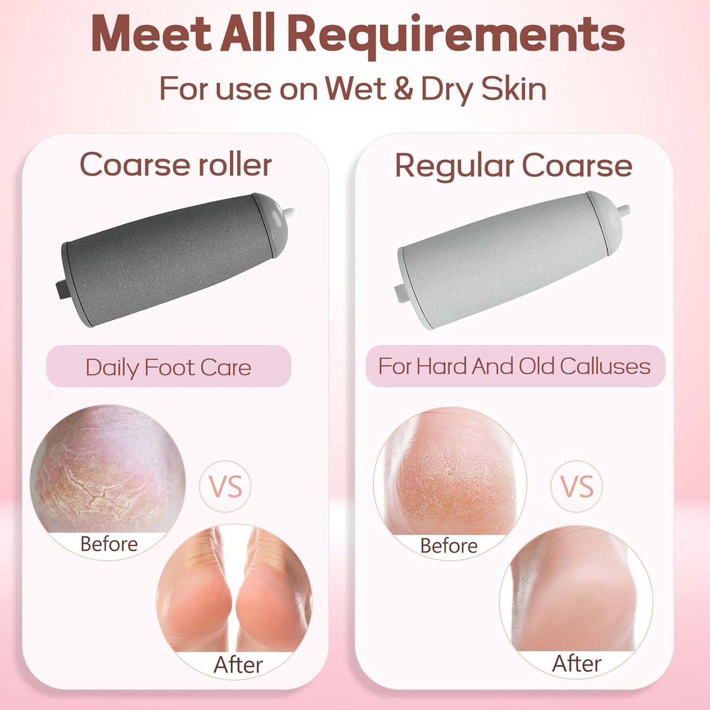 Callus Remover for Feet,  Electric Foot