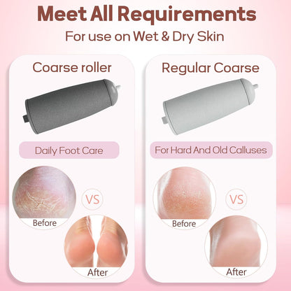 Callus Remover for Feet,  Electric Foot