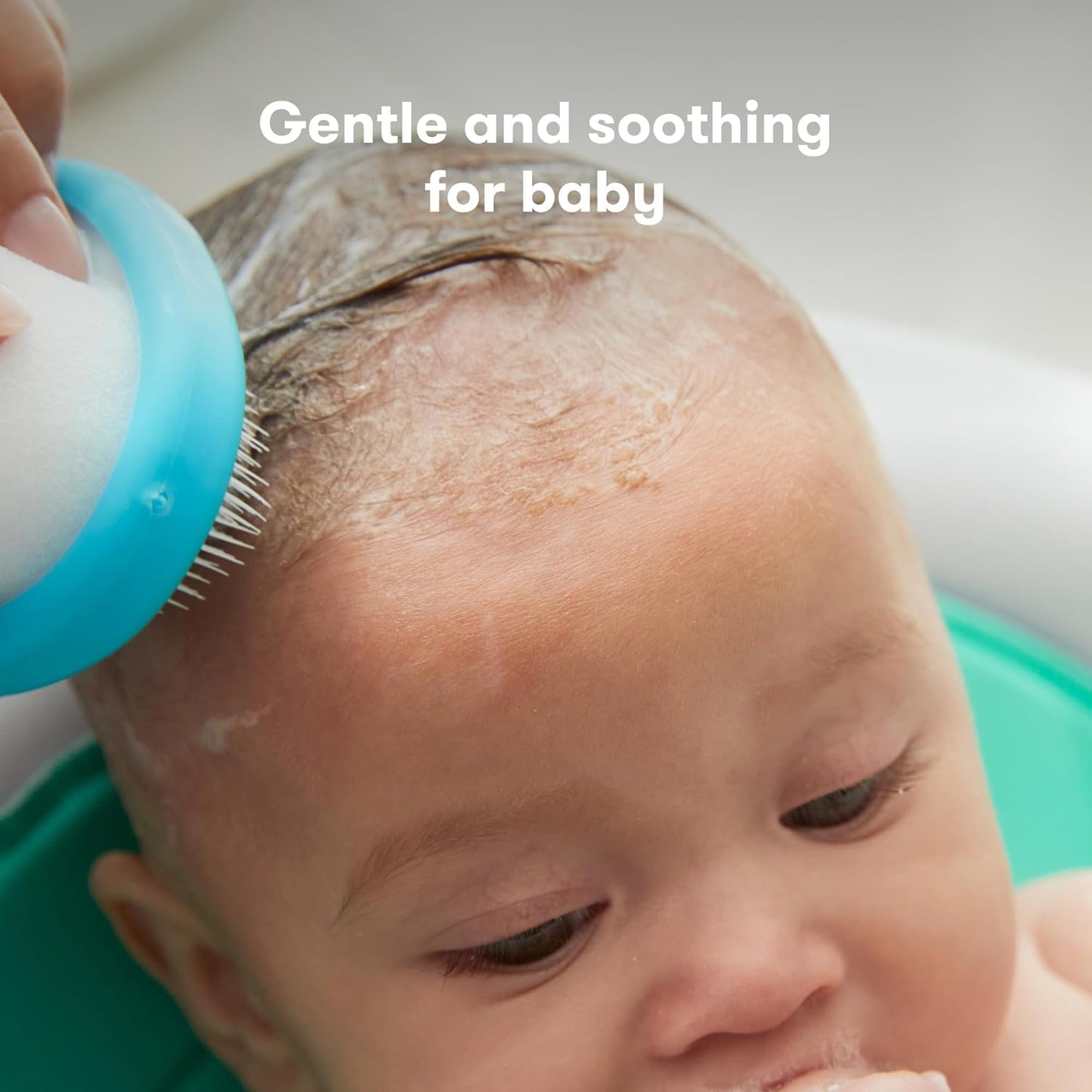 the 3-Step Cradle Cap System, Dermafrida