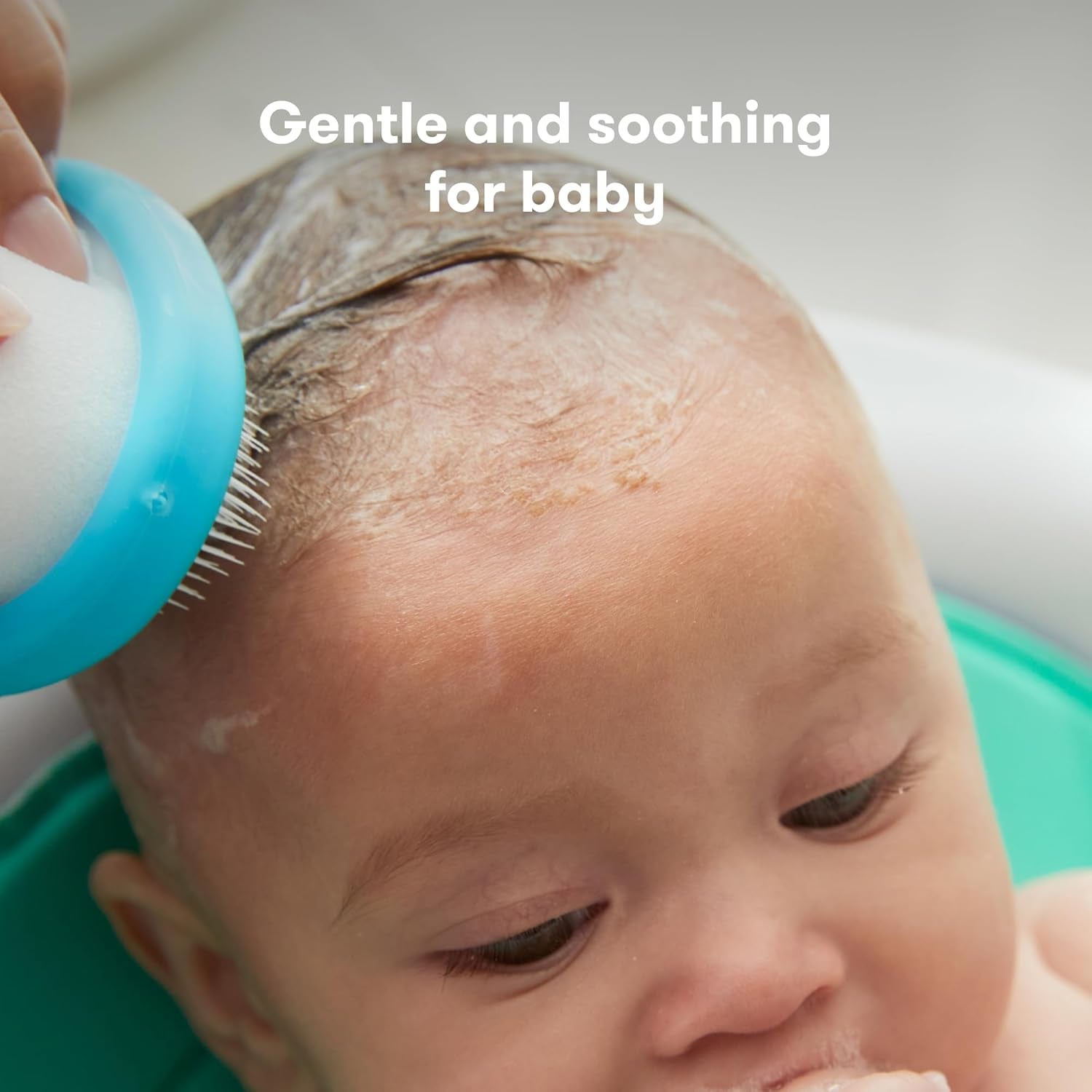 the 3-Step Cradle Cap System, Dermafrida
