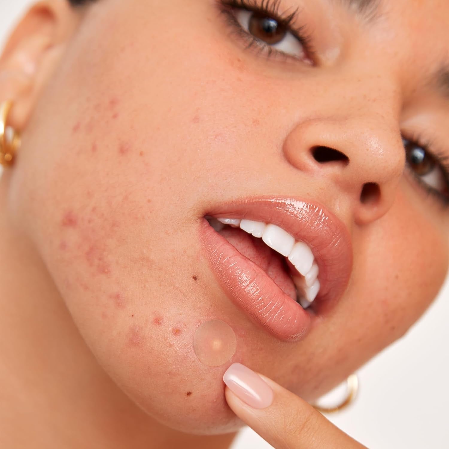 Acne Healing Dots Hydrocolloid Pimple